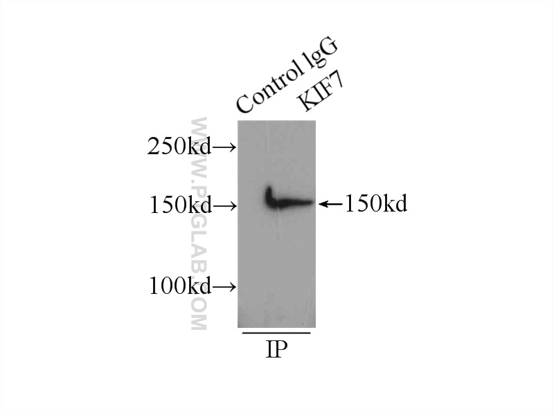 Immunoprecipitation (IP) experiment of HEK-293 cells using KIF7 Polyclonal antibody (24693-1-AP)