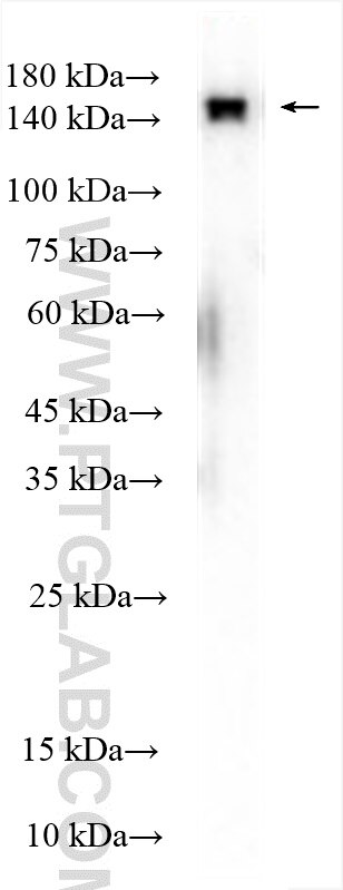 Western Blot (WB) analysis of HEK-293 cells using KIF7 Polyclonal antibody (24693-1-AP)