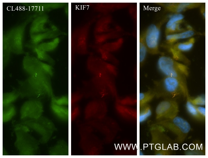 Immunofluorescence (IF) / fluorescent staining of hTERT-RPE1 cells using KIF7 Recombinant monoclonal antibody (86970-1-RR)