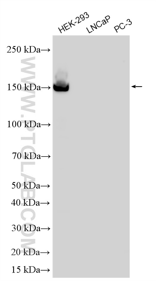 WB analysis using 86970-1-RR (same clone as 86970-1-PBS) Western Blot (WB) analysis of various lysates using KIF7 Recombinant monoclonal antibody (86970-1-RR)
