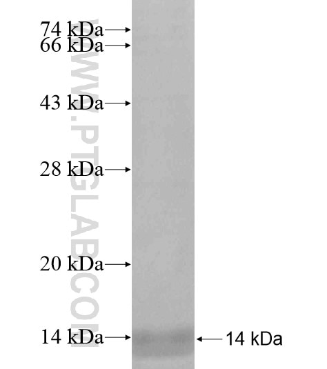 KIF7 fusion protein Ag19119 SDS-PAGE