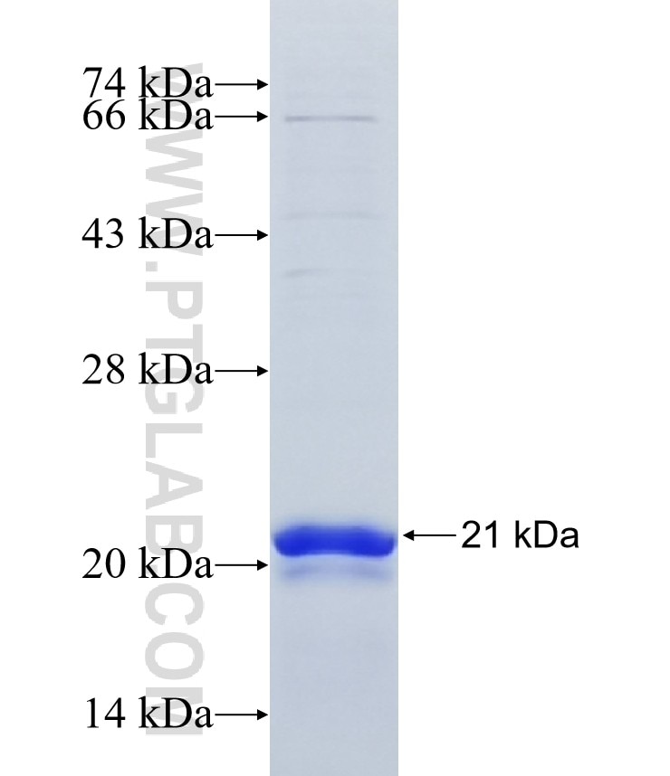 KIF7 fusion protein Ag19119 SDS-PAGE