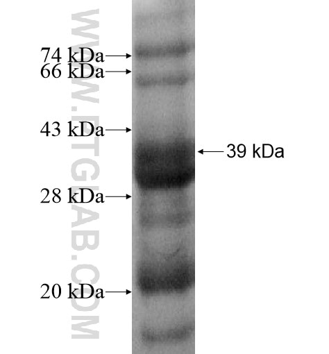 KIF9 fusion protein Ag13189 SDS-PAGE