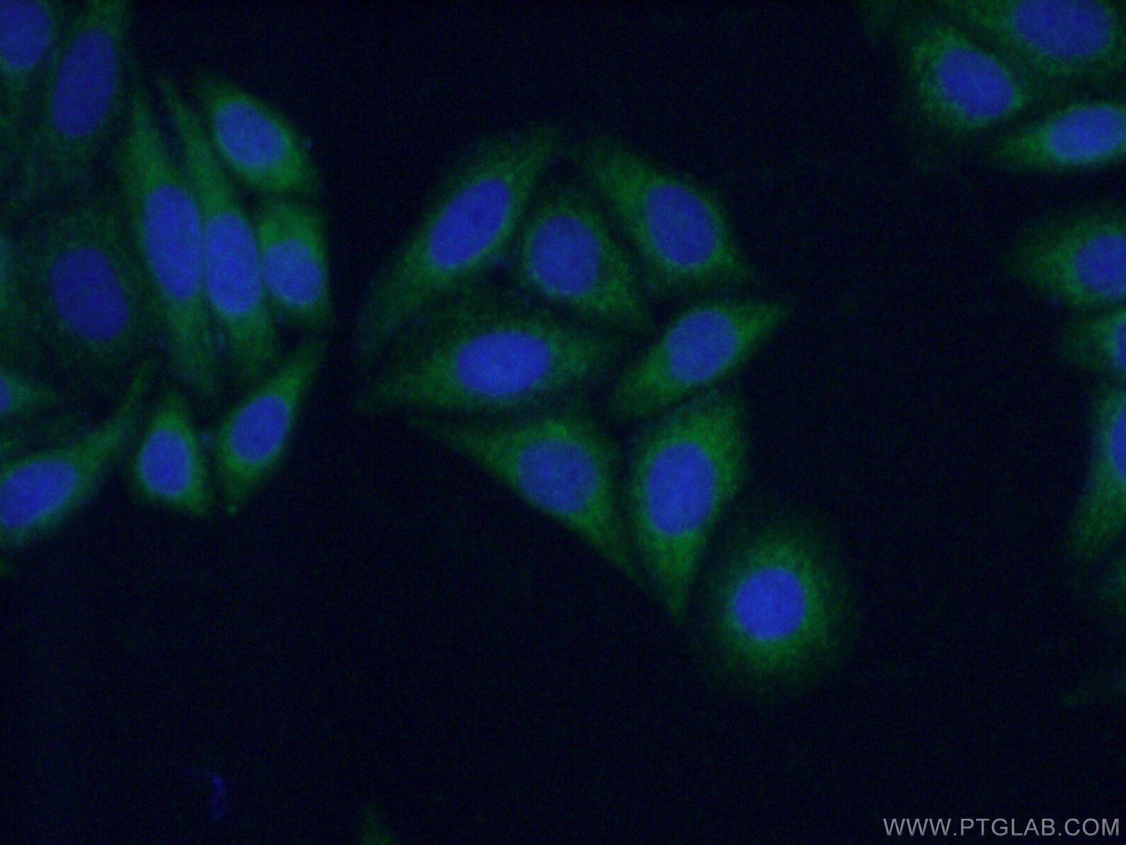 Immunofluorescence (IF) / fluorescent staining of HepG2 cells using KIFAP3 Polyclonal antibody (12700-1-AP)