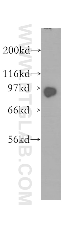 Western Blot (WB) analysis of human brain tissue using KIFAP3 Polyclonal antibody (12700-1-AP)