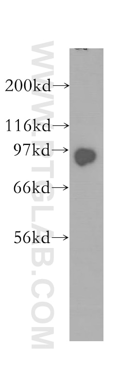 WB analysis of human brain using 12700-1-AP