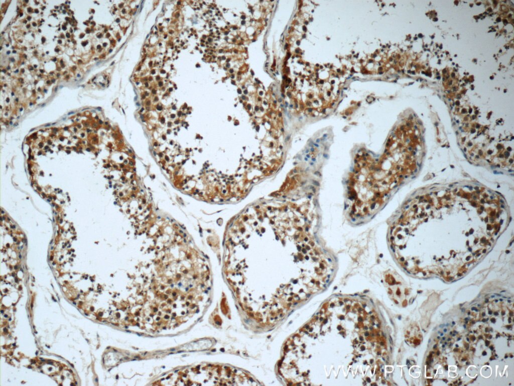 Immunohistochemistry (IHC) staining of human testis tissue using KIFAP3 Monoclonal antibody (60266-1-Ig)