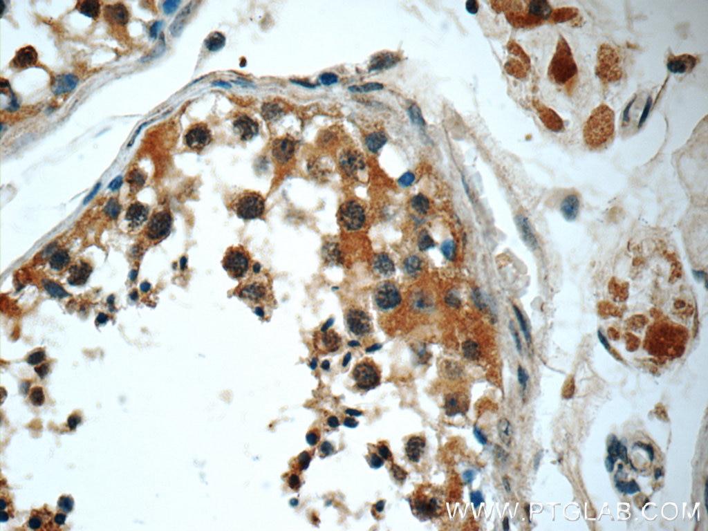 Immunohistochemistry (IHC) staining of human testis tissue using KIFAP3 Monoclonal antibody (60266-1-Ig)