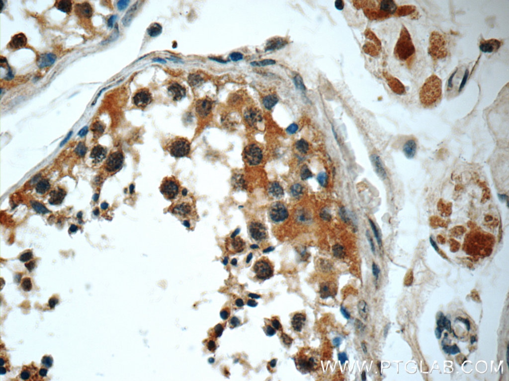 IHC staining of human testis using 60266-1-Ig