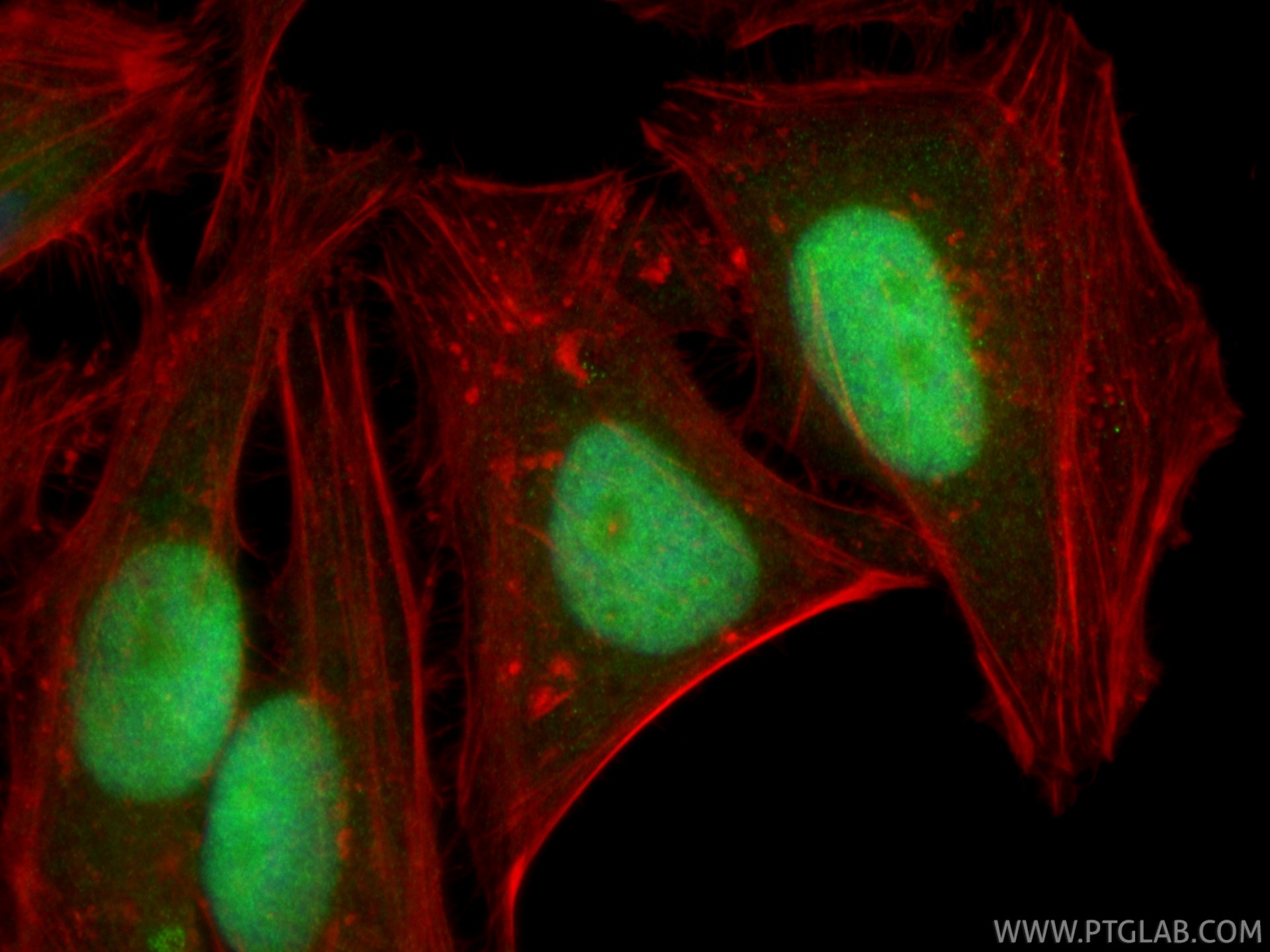Immunofluorescence (IF) / fluorescent staining of HeLa cells using KIFC1 Polyclonal antibody (20790-1-AP)