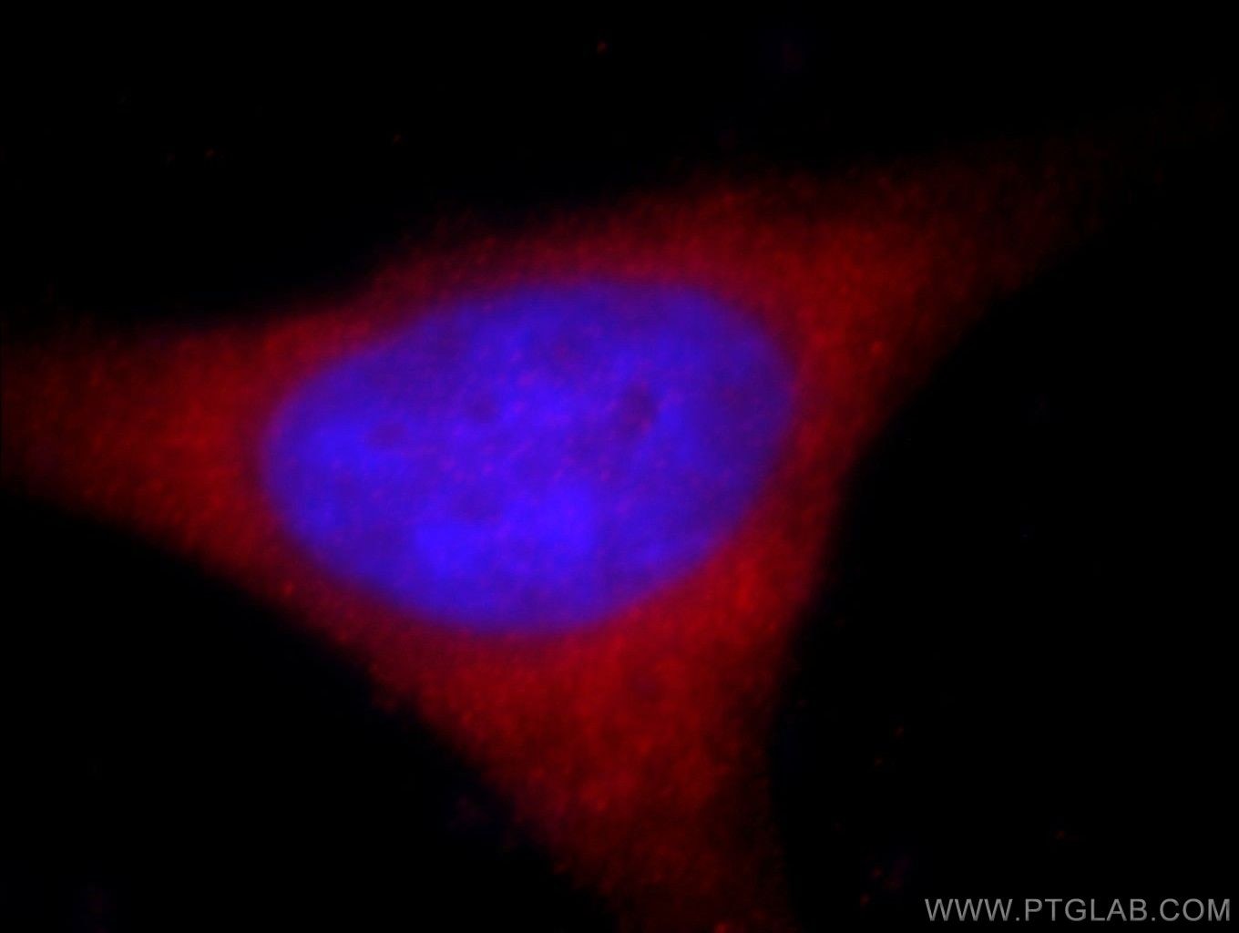 Immunofluorescence (IF) / fluorescent staining of HeLa cells using KIFC1 Polyclonal antibody (20790-1-AP)