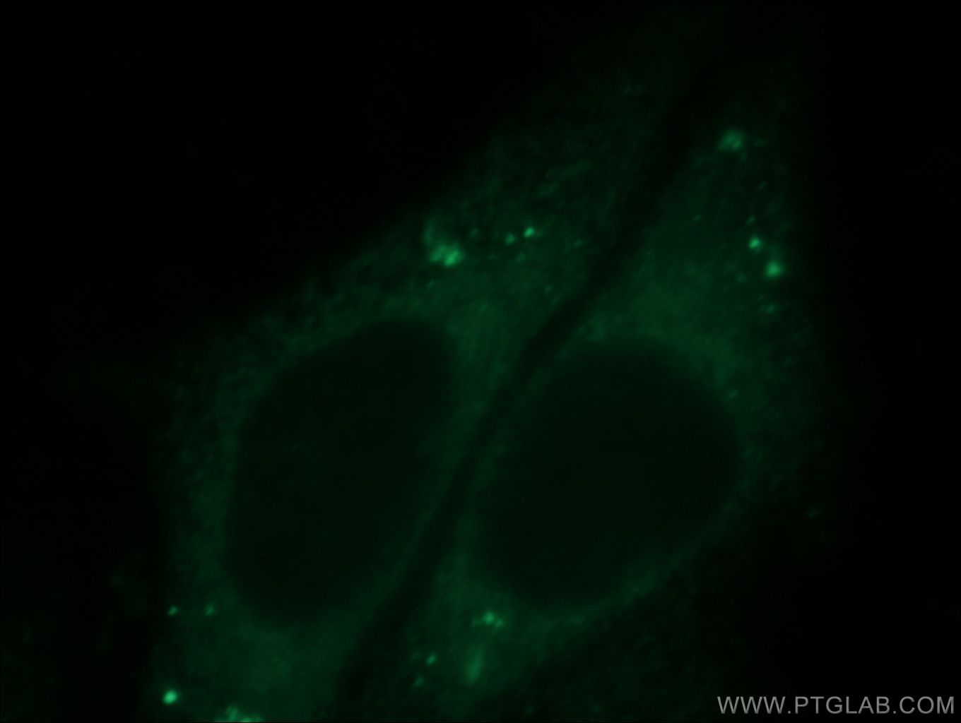 Immunofluorescence (IF) / fluorescent staining of HepG2 cells using KIFC1 Polyclonal antibody (20790-1-AP)
