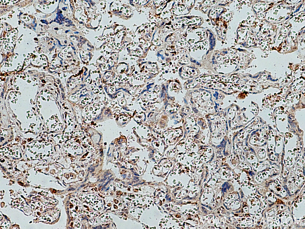 Immunohistochemistry (IHC) staining of human placenta tissue using KIFC1 Polyclonal antibody (20790-1-AP)