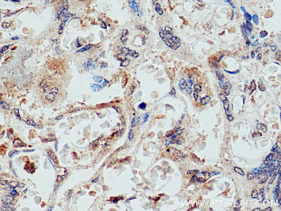Immunohistochemistry (IHC) staining of human placenta tissue using KIFC1 Polyclonal antibody (20790-1-AP)