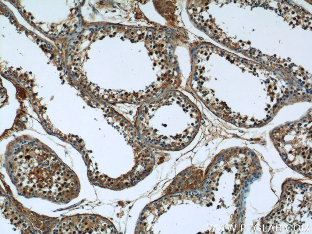 Immunohistochemistry (IHC) staining of human testis tissue using KIFC1 Polyclonal antibody (20790-1-AP)