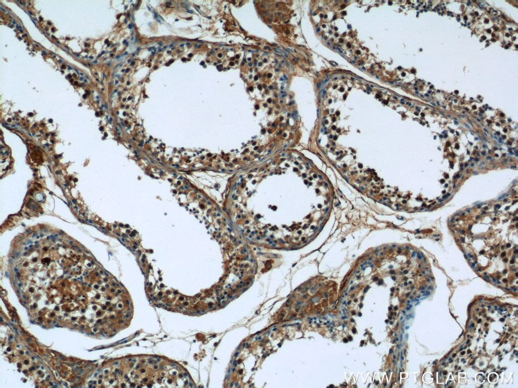 IHC staining of human testis using 20790-1-AP