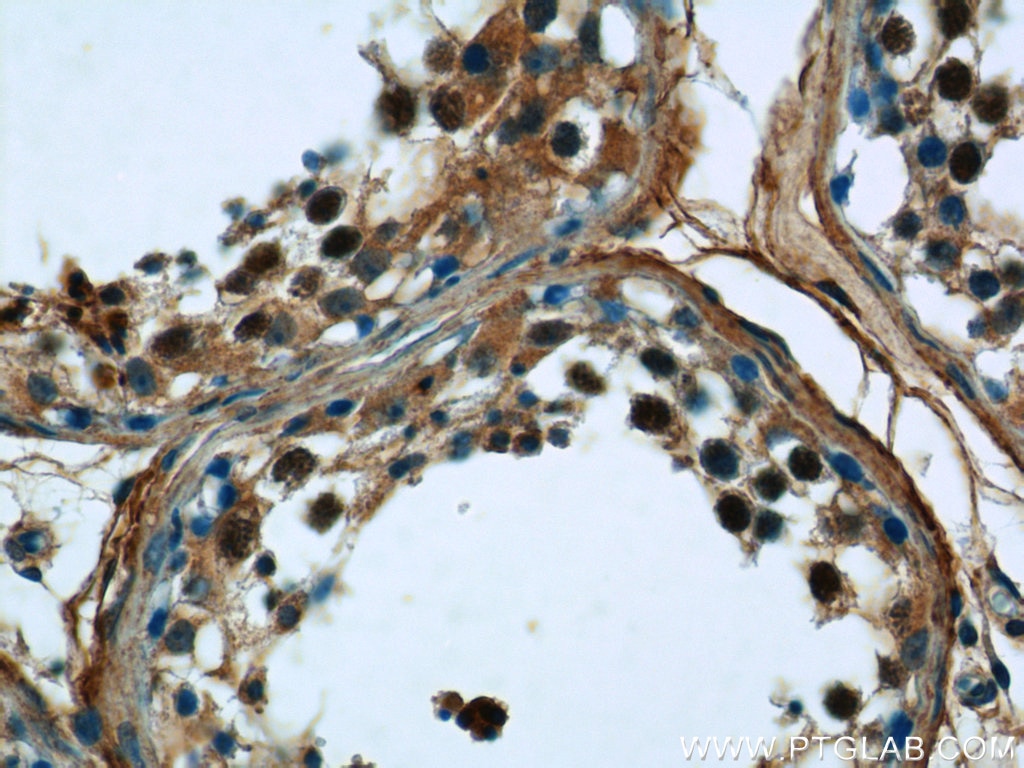 Immunohistochemistry (IHC) staining of human testis tissue using KIFC1 Polyclonal antibody (20790-1-AP)