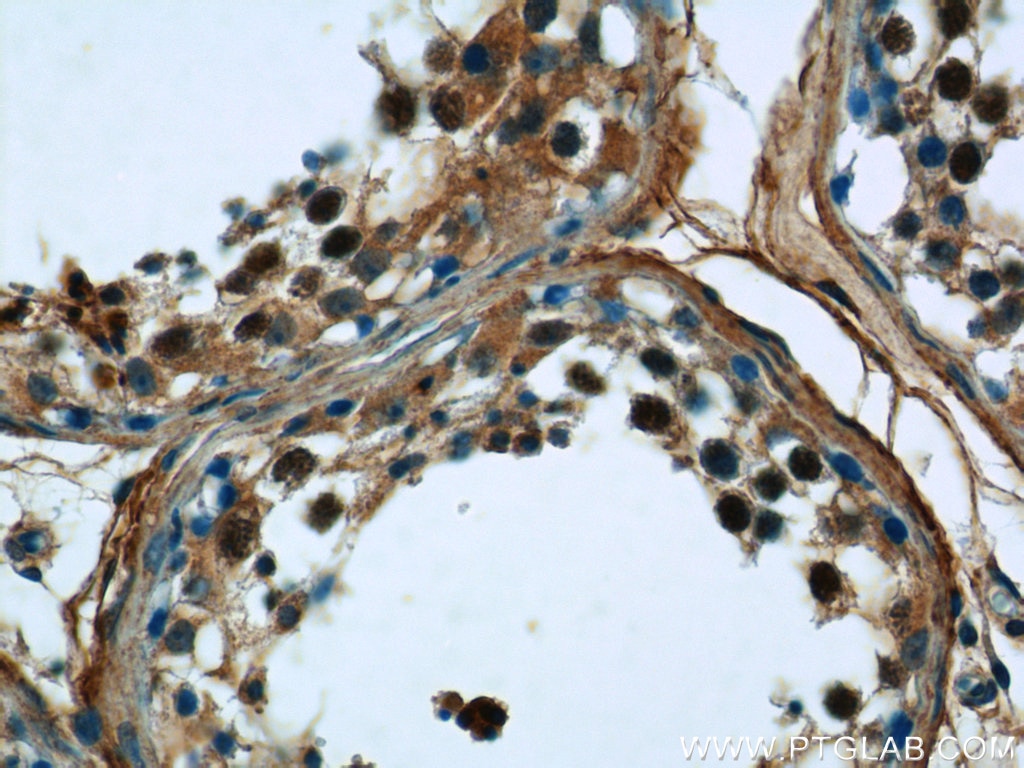 IHC staining of human testis using 20790-1-AP