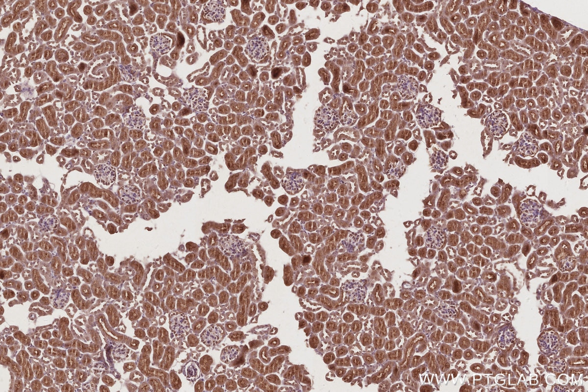 Immunohistochemistry (IHC) staining of mouse kidney tissue using KIFC1 Polyclonal antibody (20790-1-AP)