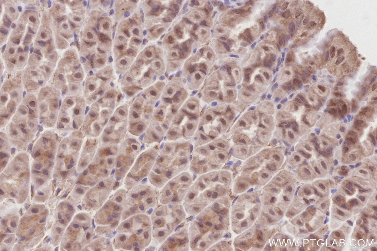 Immunohistochemistry (IHC) staining of mouse stomach tissue using KIFC1 Polyclonal antibody (20790-1-AP)