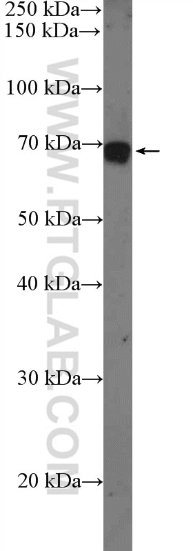 Western Blot (WB) analysis of mouse testis tissue using KIFC1 Polyclonal antibody (20790-1-AP)