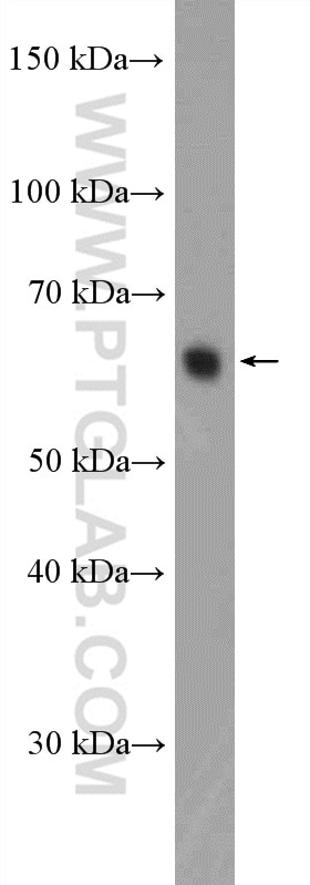Western Blot (WB) analysis of rat testis tissue using KIFC1 Polyclonal antibody (20790-1-AP)