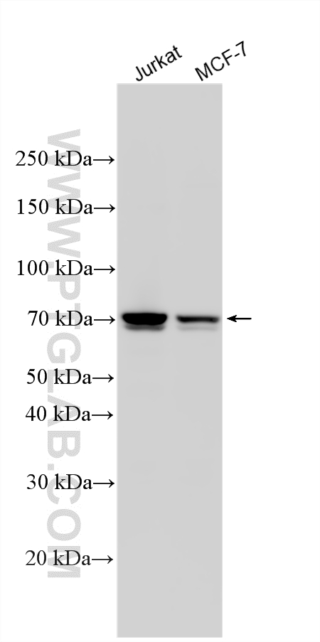 Western Blot (WB) analysis of various lysates using KIFC1 Polyclonal antibody (20790-1-AP)