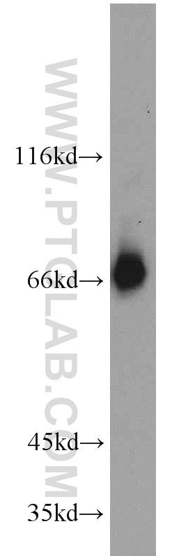 Western Blot (WB) analysis of HeLa cells using KIFC1 Polyclonal antibody (20790-1-AP)