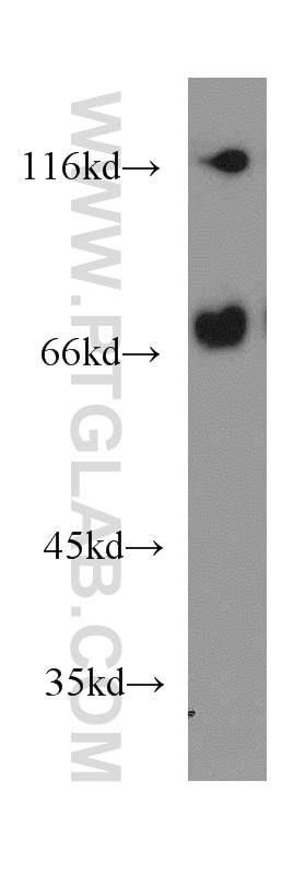 Western Blot (WB) analysis of NIH/3T3 cells using KIFC1 Polyclonal antibody (20790-1-AP)