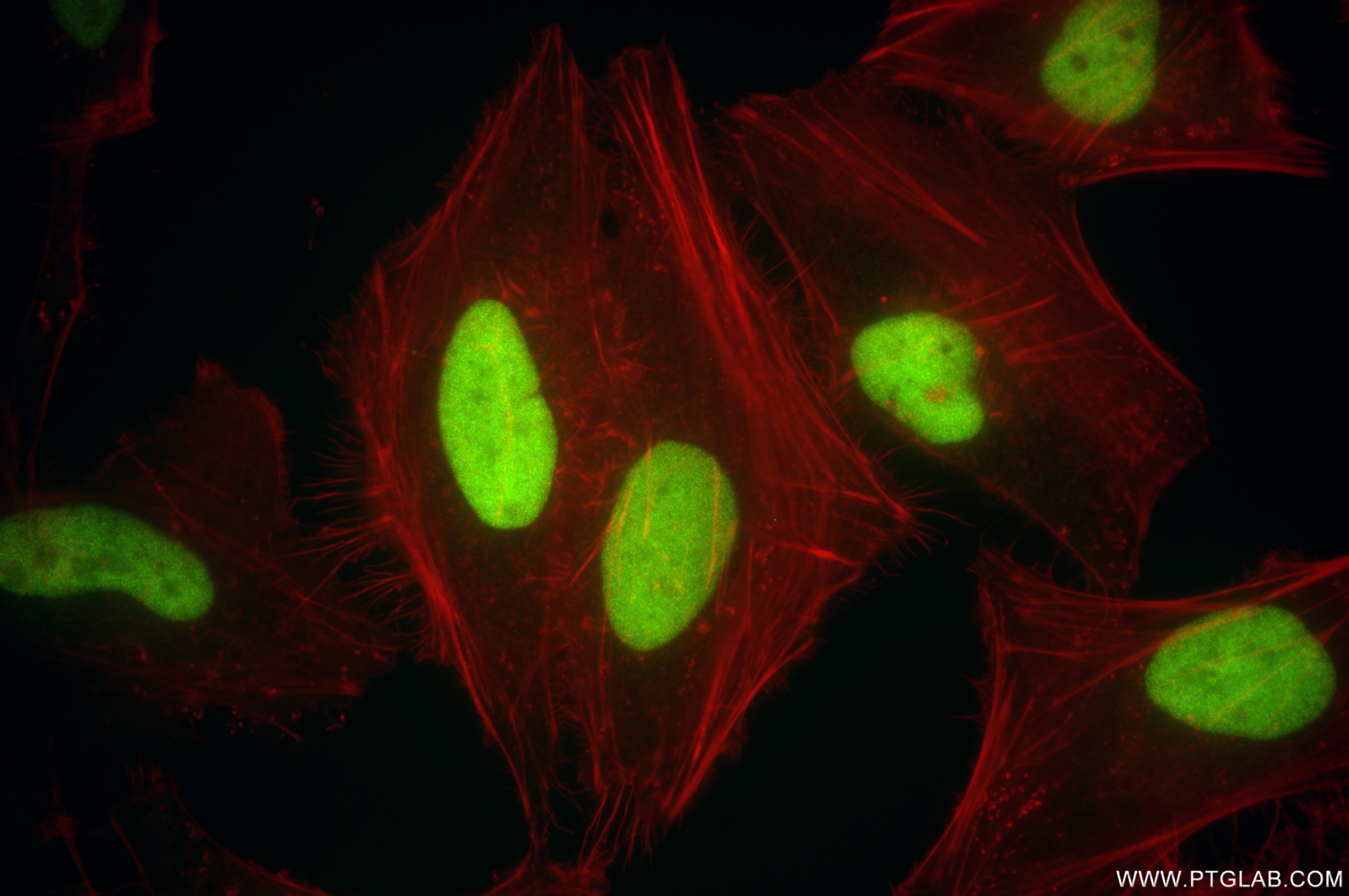 Immunofluorescence (IF) / fluorescent staining of HeLa cells using KIFC1 Recombinant antibody (85981-1-RR)