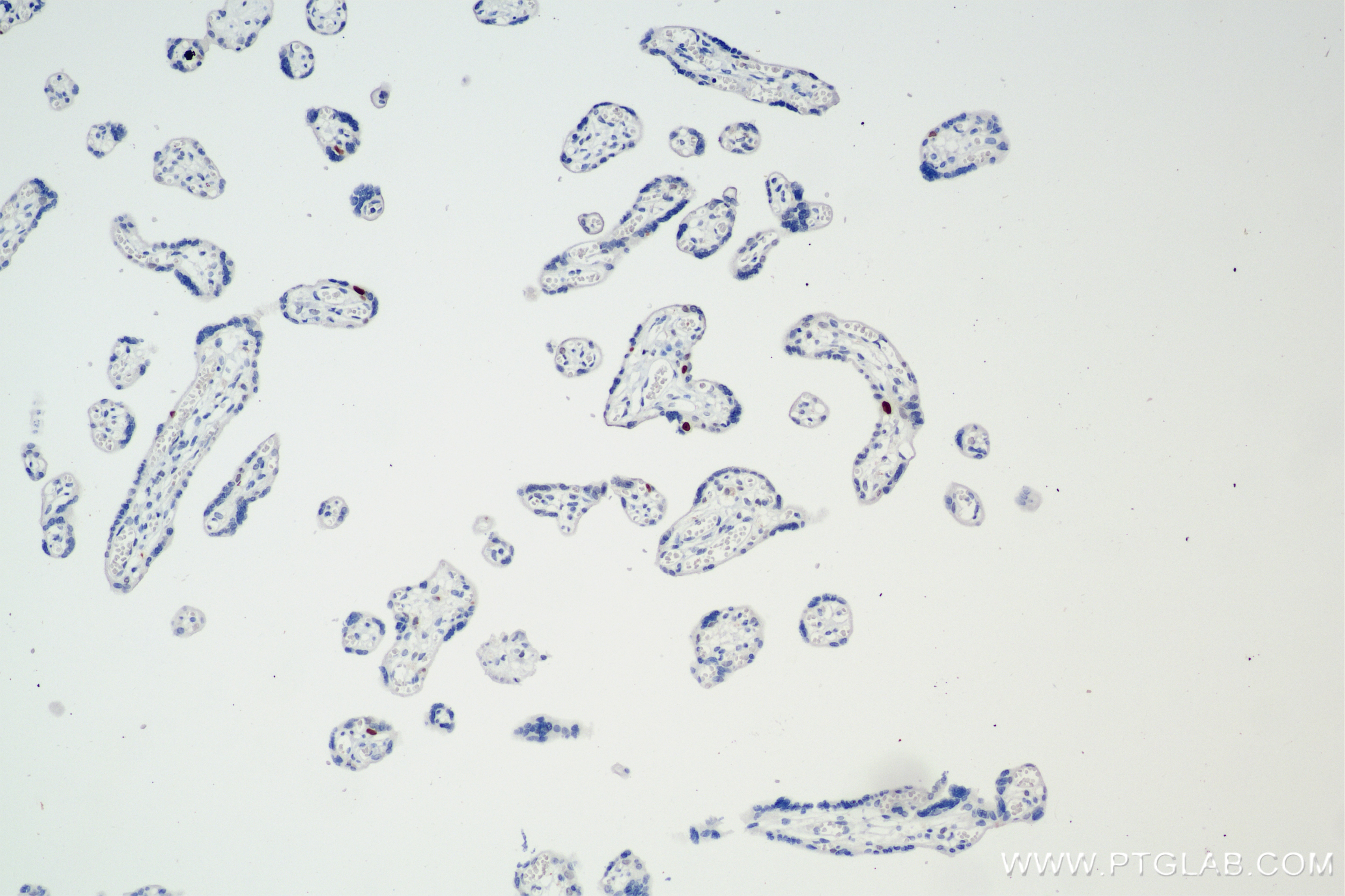 Immunohistochemistry (IHC) staining of human placenta tissue using KIFC1 Recombinant antibody (85981-1-RR)