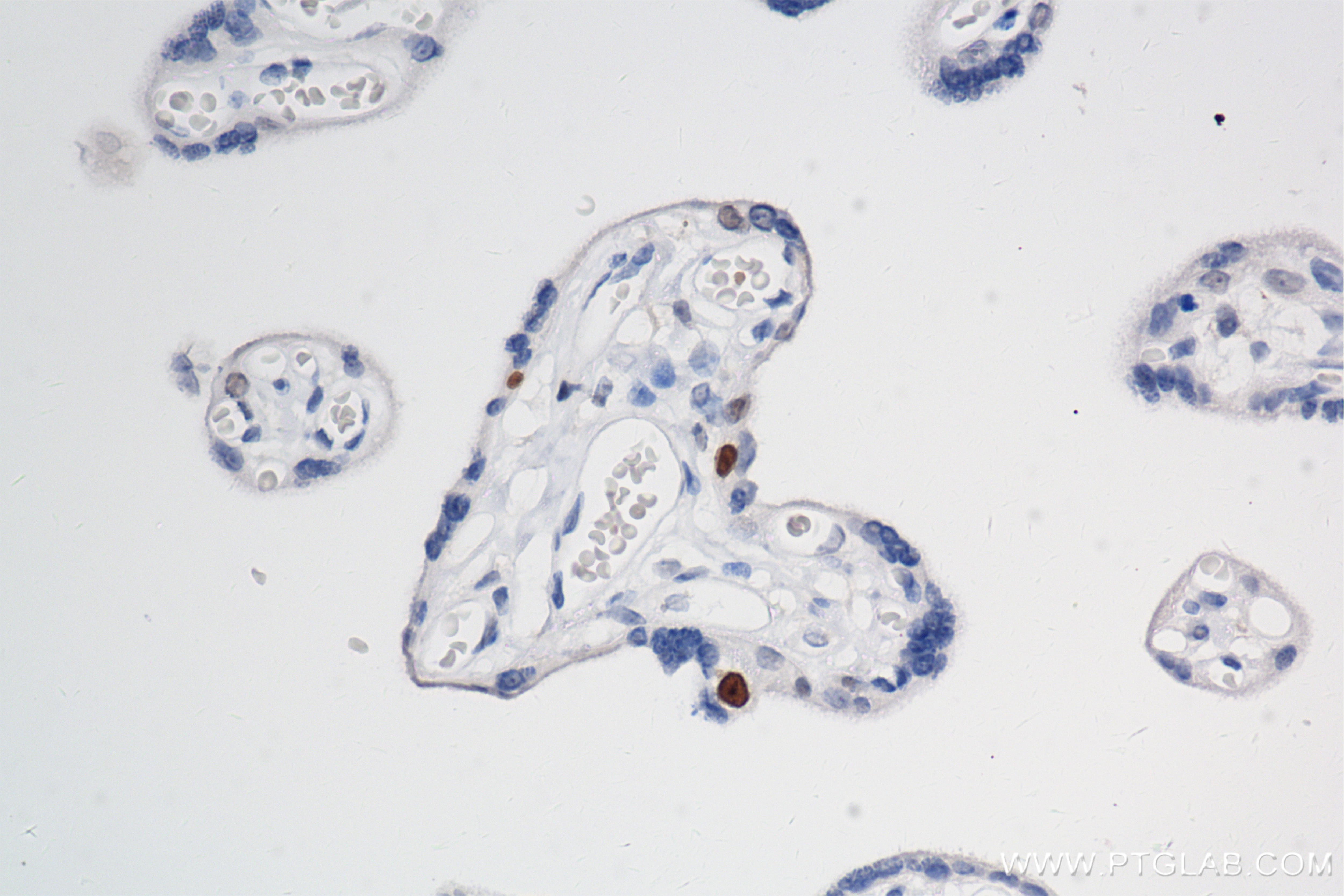Immunohistochemistry (IHC) staining of human placenta tissue using KIFC1 Recombinant antibody (85981-1-RR)