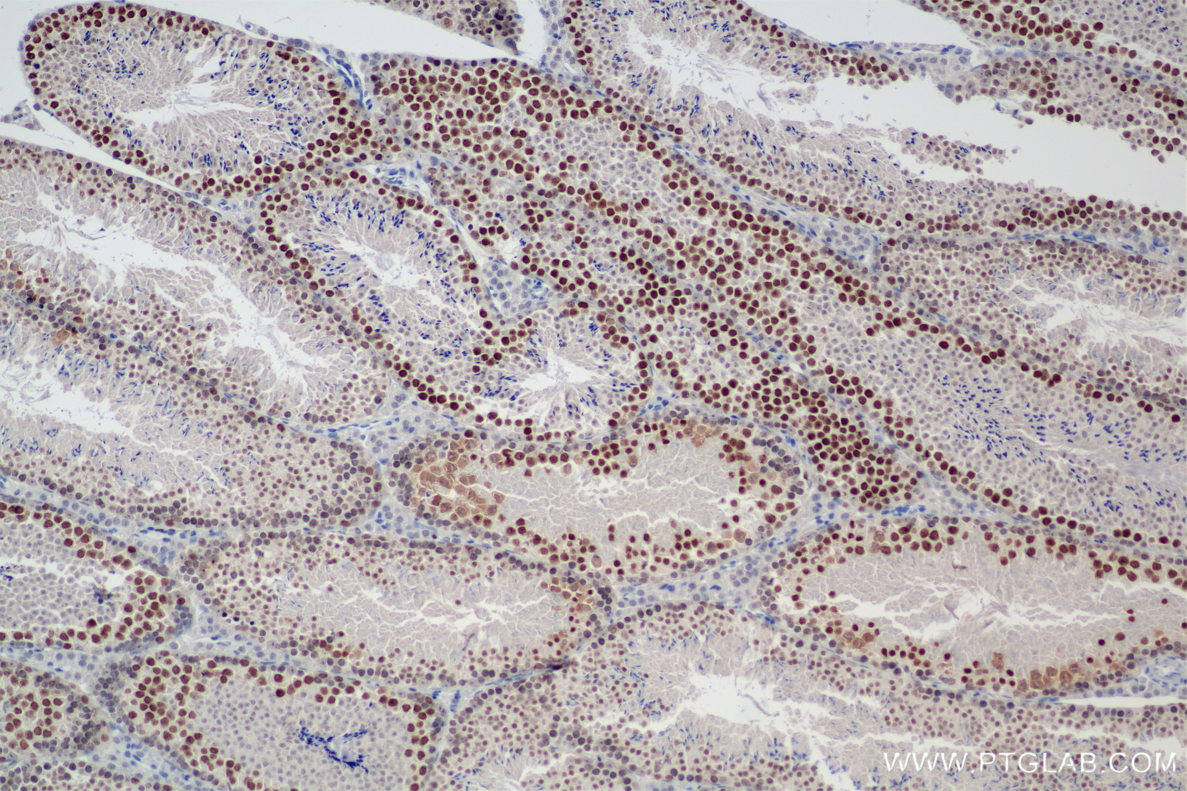 Immunohistochemistry (IHC) staining of mouse testis tissue using KIFC1 Recombinant antibody (85981-1-RR)
