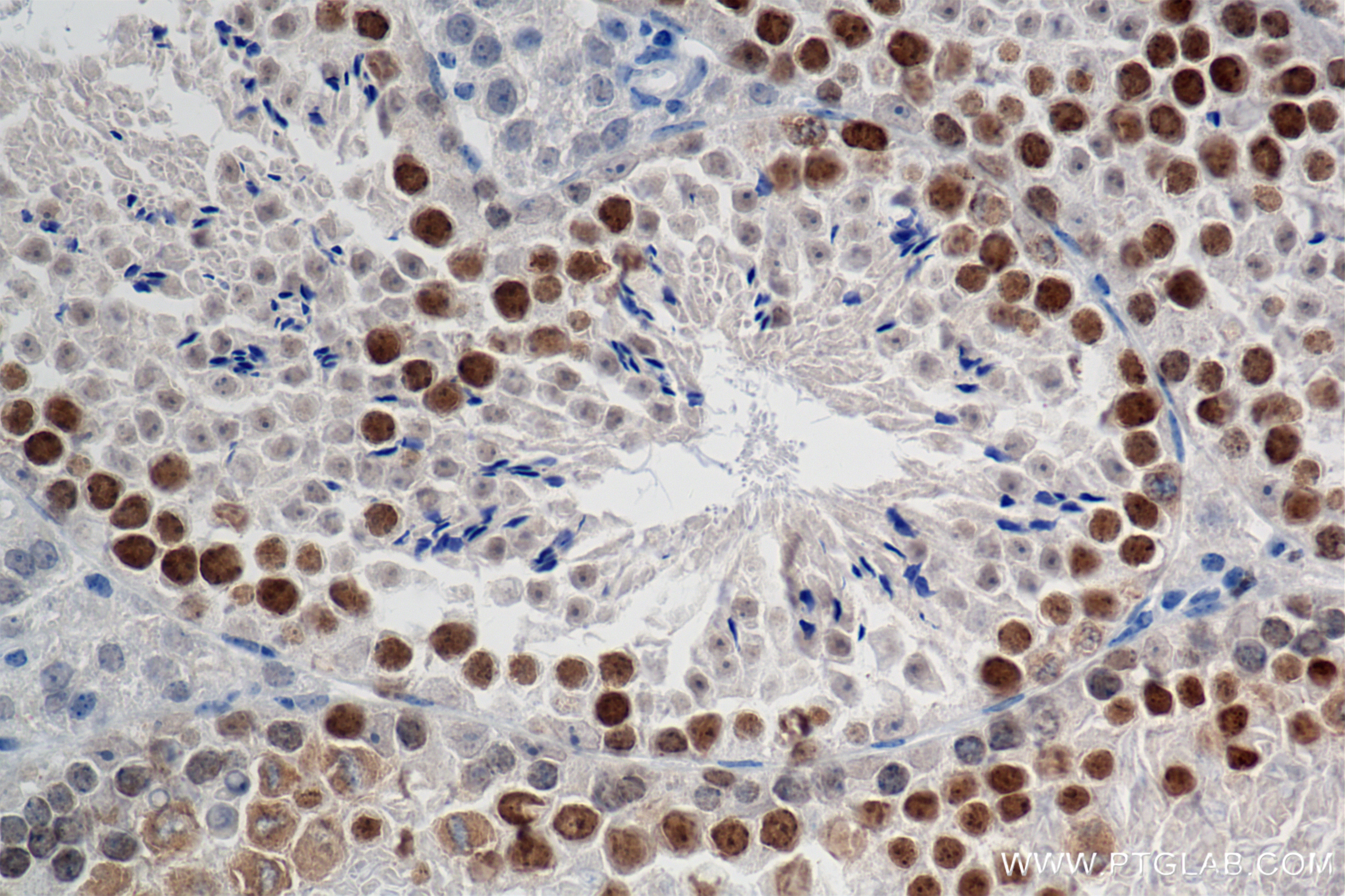 Immunohistochemistry (IHC) staining of mouse testis tissue using KIFC1 Recombinant antibody (85981-1-RR)