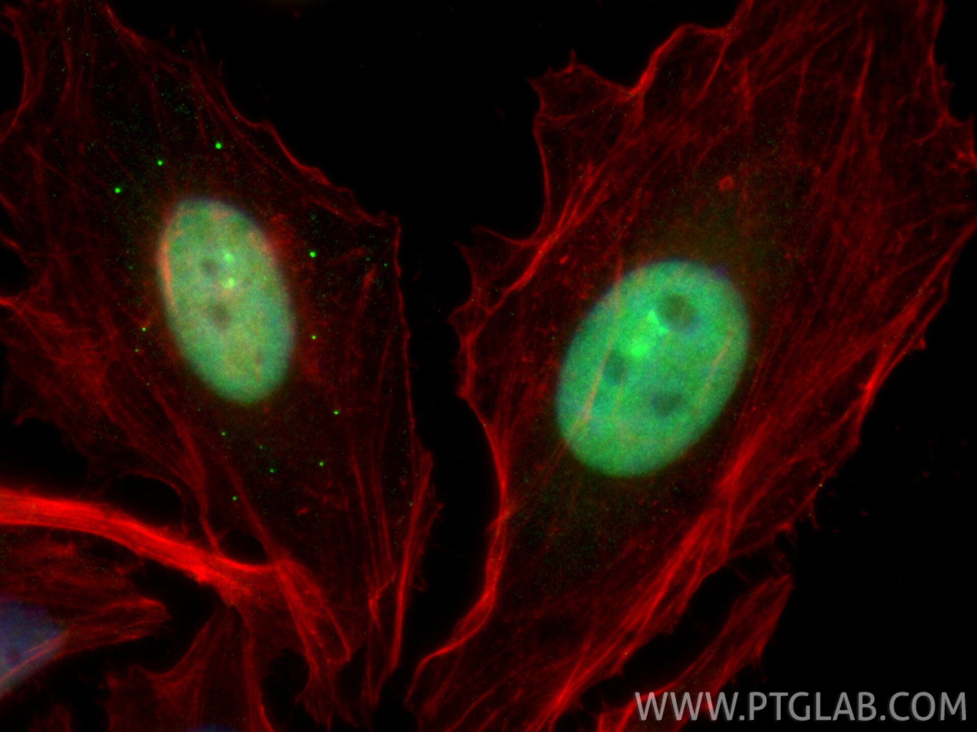 Immunofluorescence (IF) / fluorescent staining of HeLa cells using CoraLite® Plus 488-conjugated KIFC1 Recombinant mo (CL488-85981)
