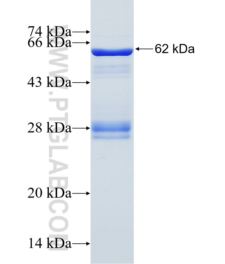 KIFC1 fusion protein Ag14338 SDS-PAGE KIFC1 fusion protein Ag14338 SDS-PAGE