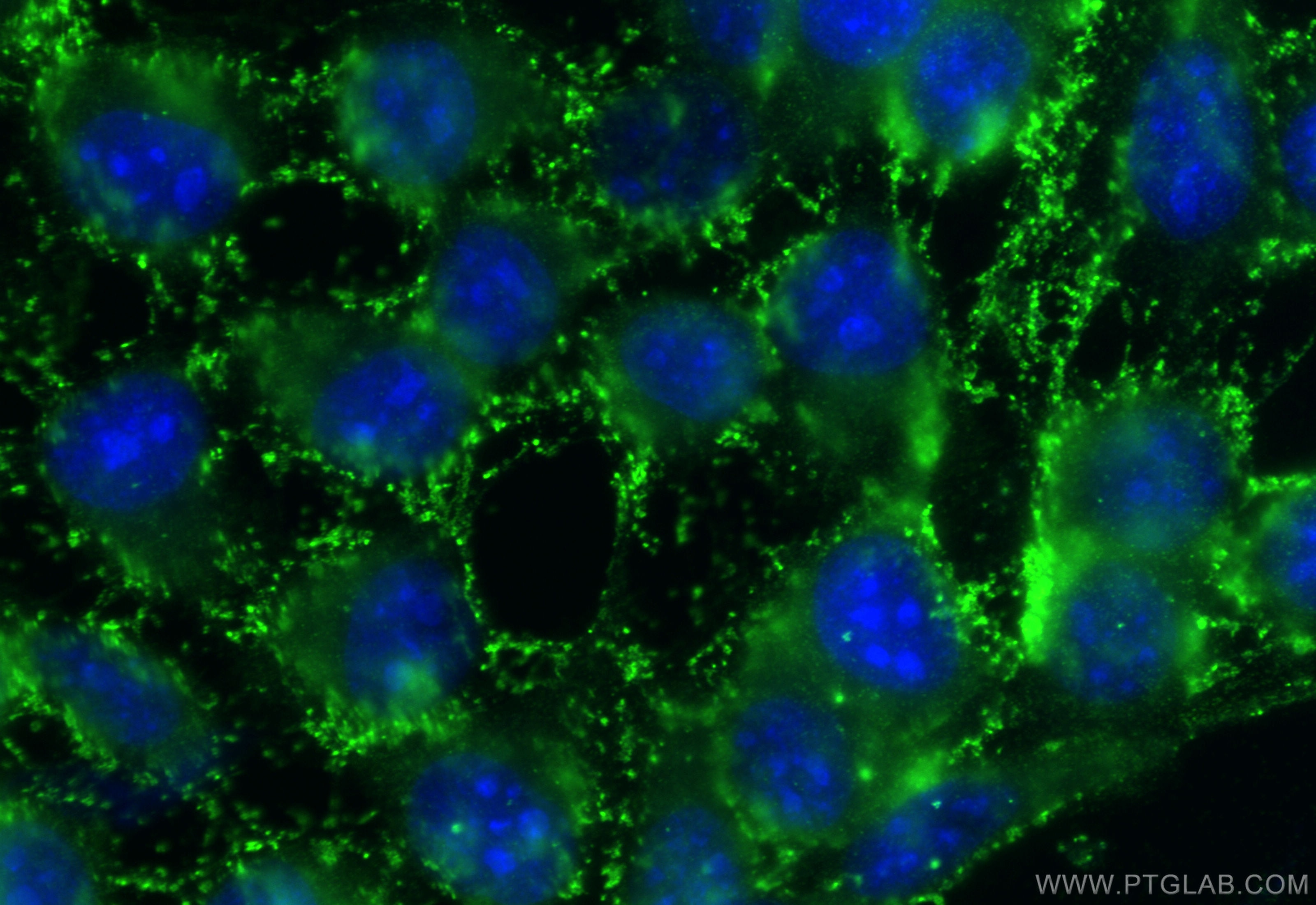 Immunofluorescence (IF) / fluorescent staining of A431 cells using KIFC2 Polyclonal antibody (27470-1-AP)