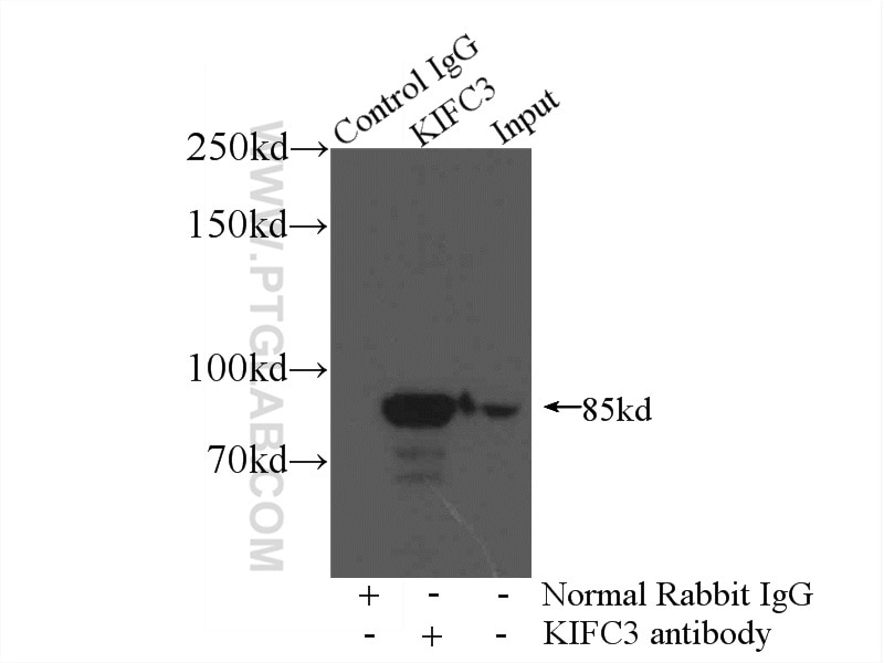 Immunoprecipitation (IP) experiment of mouse kidney tissue using KIFC3 Polyclonal antibody (10125-2-AP)