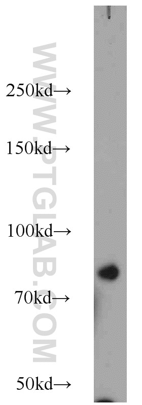 Western Blot (WB) analysis of mouse kidney tissue using KIFC3 Polyclonal antibody (10125-2-AP)