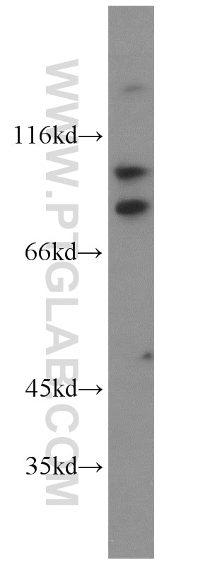 Western Blot (WB) analysis of mouse lung tissue using KIFC3 Polyclonal antibody (10125-2-AP)