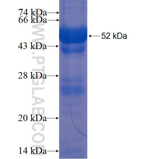 KIFC3 fusion protein Ag0172 SDS-PAGE