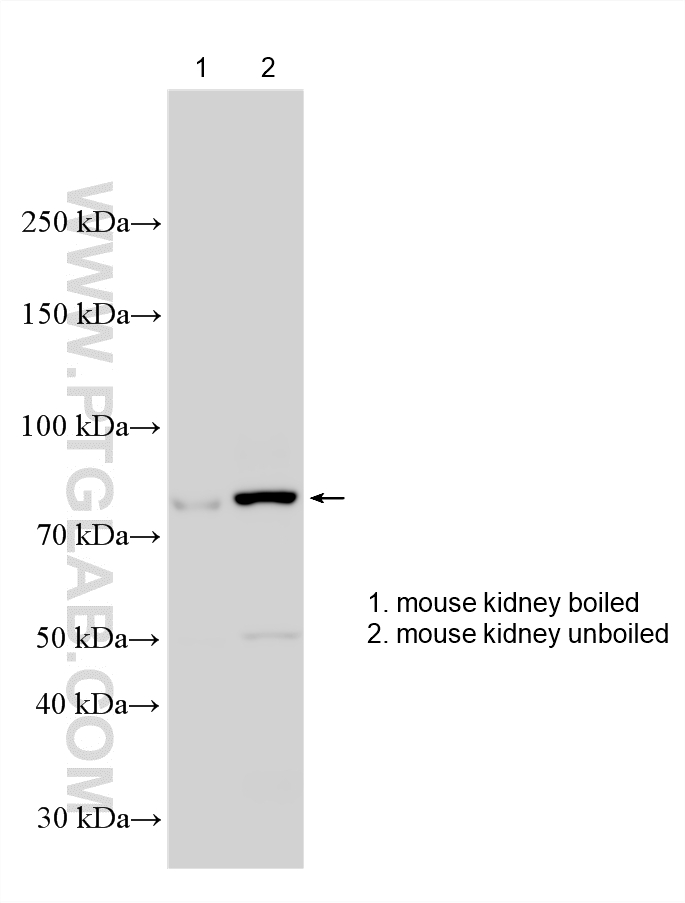WB analysis using 83221-2-RR Western Blot (WB) analysis of various lysates using KIM-1/HAVCR1 Recombinant monoclonal antibody (83221-2-RR)