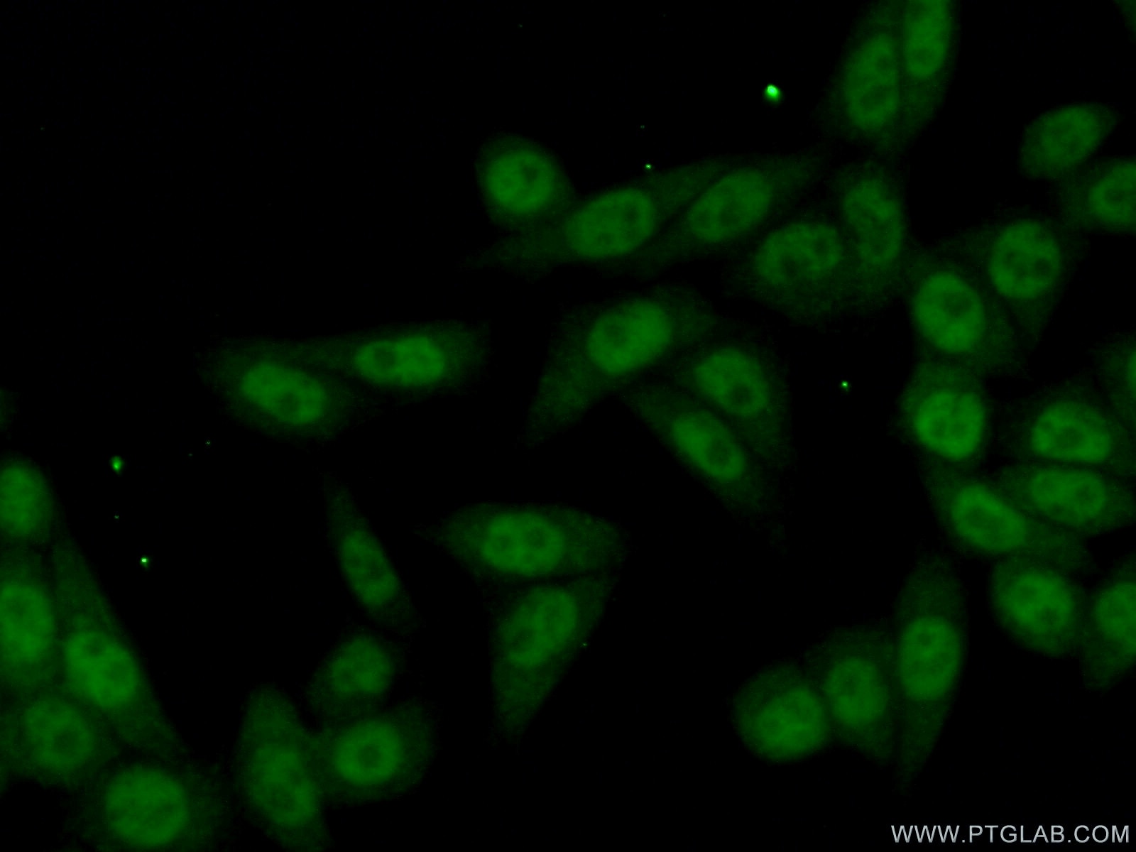 Immunofluorescence (IF) / fluorescent staining of HeLa cells using KIN17 Polyclonal antibody (12313-1-AP)