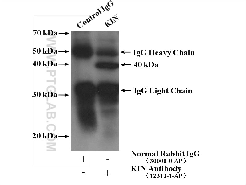 Immunoprecipitation (IP) experiment of mouse brain tissue using KIN17 Polyclonal antibody (12313-1-AP)