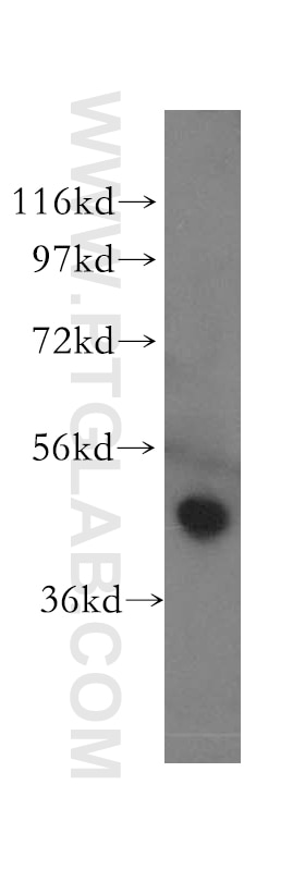 Western Blot (WB) analysis of HeLa cells using KIN17 Polyclonal antibody (12313-1-AP)