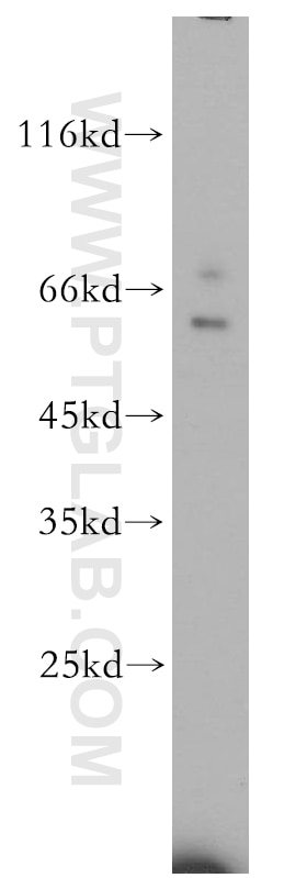 Western Blot (WB) analysis of human liver tissue using KIR2DL3 Polyclonal antibody (18966-1-AP)