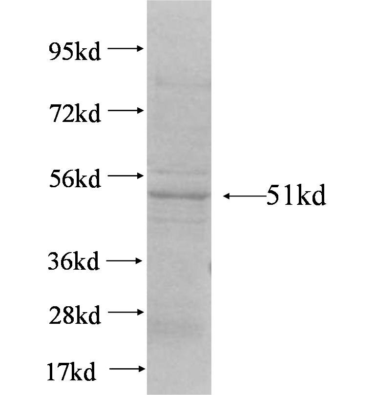 KIR2DL3 fusion protein Ag4301 SDS-PAGE