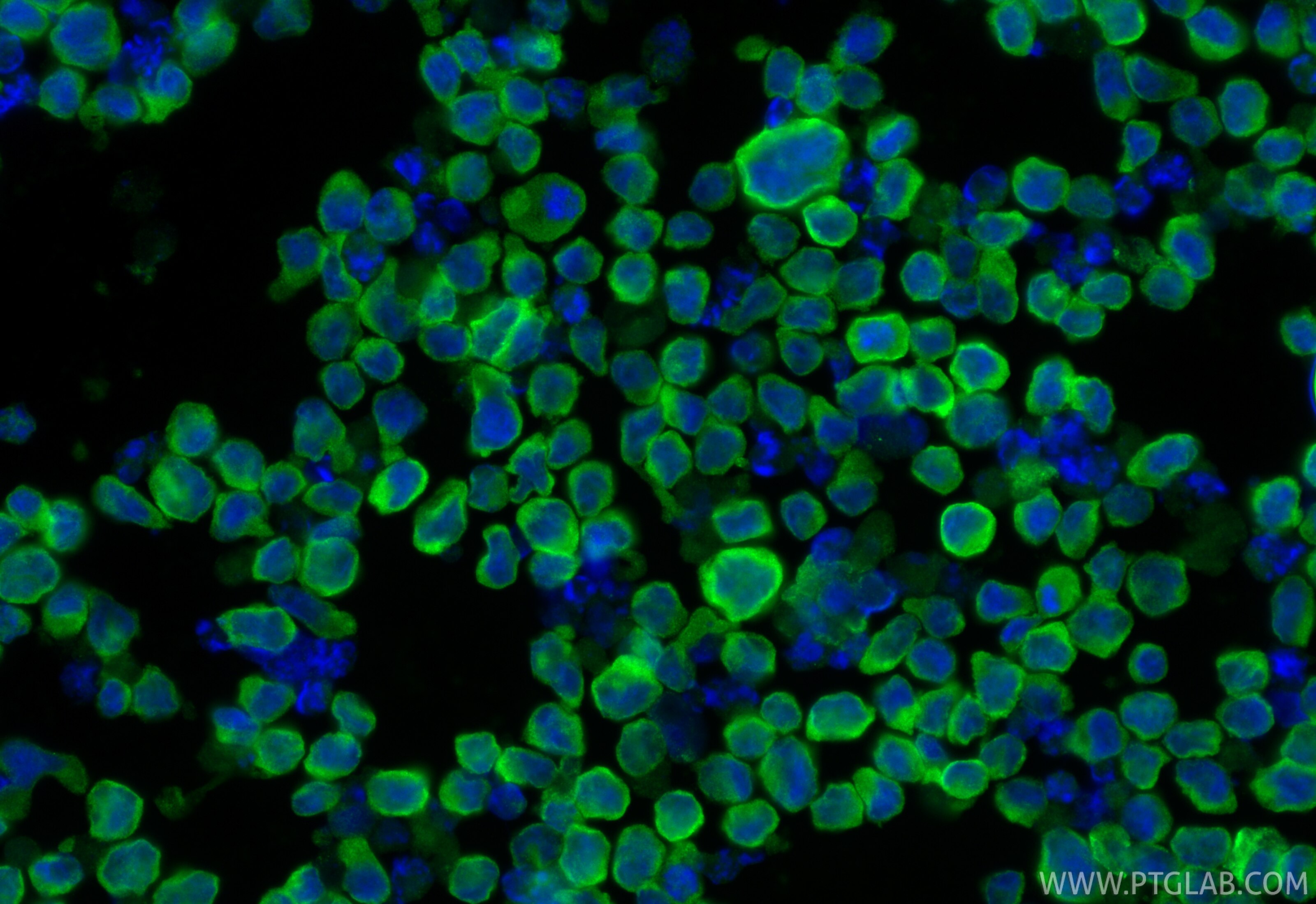 Immunofluorescence (IF) / fluorescent staining of NK-92 cells using KIR2DL4/CD158d Polyclonal antibody (32059-1-AP)