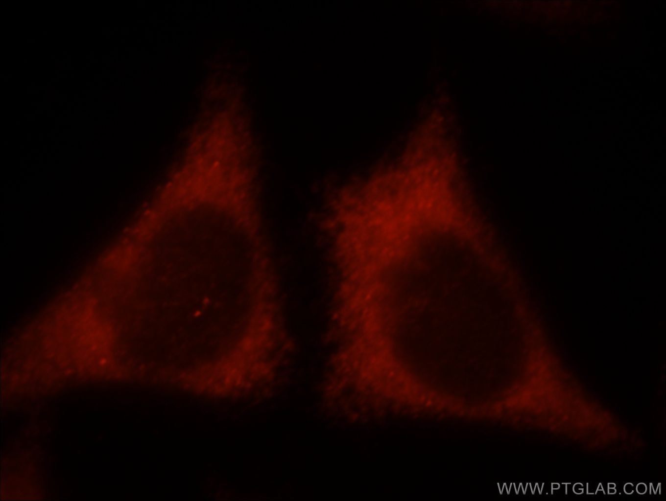 Immunofluorescence (IF) / fluorescent staining of HepG2 cells using KIR2DS4 Polyclonal antibody (21152-1-AP)