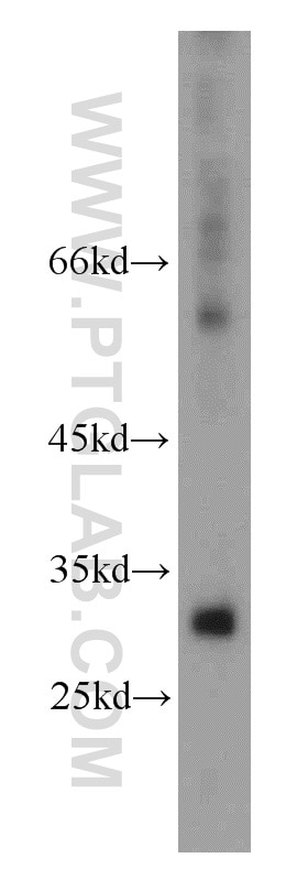 Western Blot (WB) analysis of Jurkat cells using KIR2DS4 Polyclonal antibody (21152-1-AP)